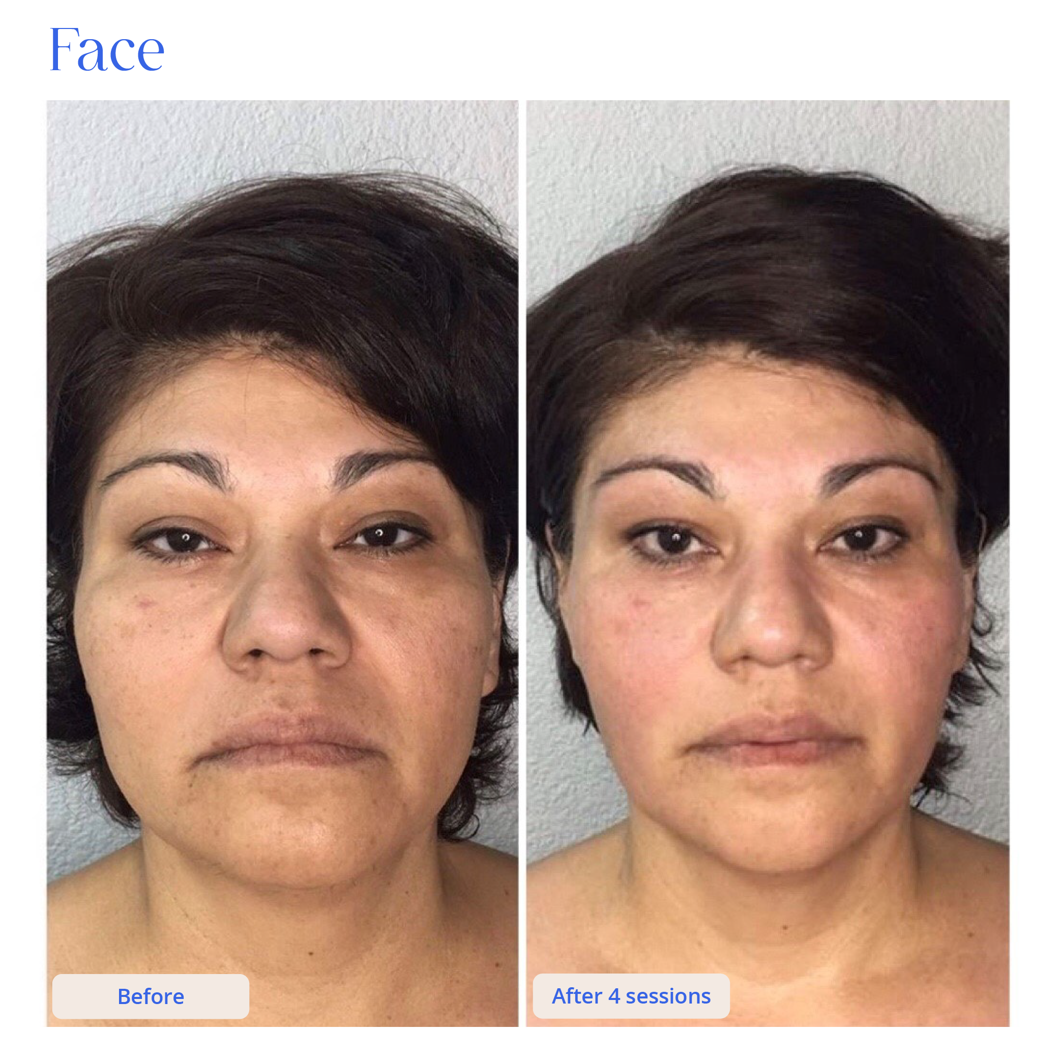 Before and After Result 10