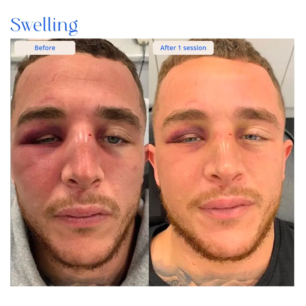 Before and After Result 14