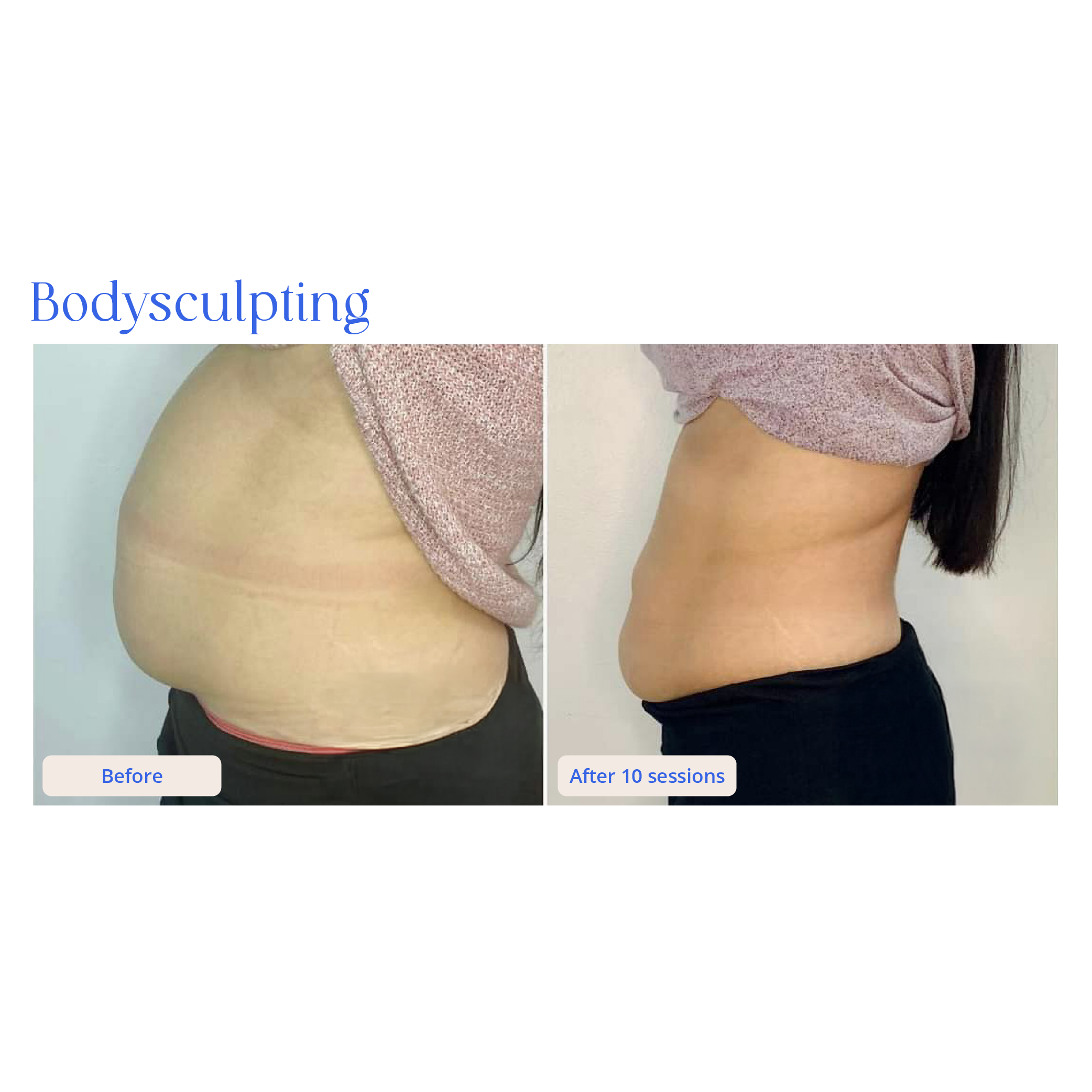 Before and After Result 4