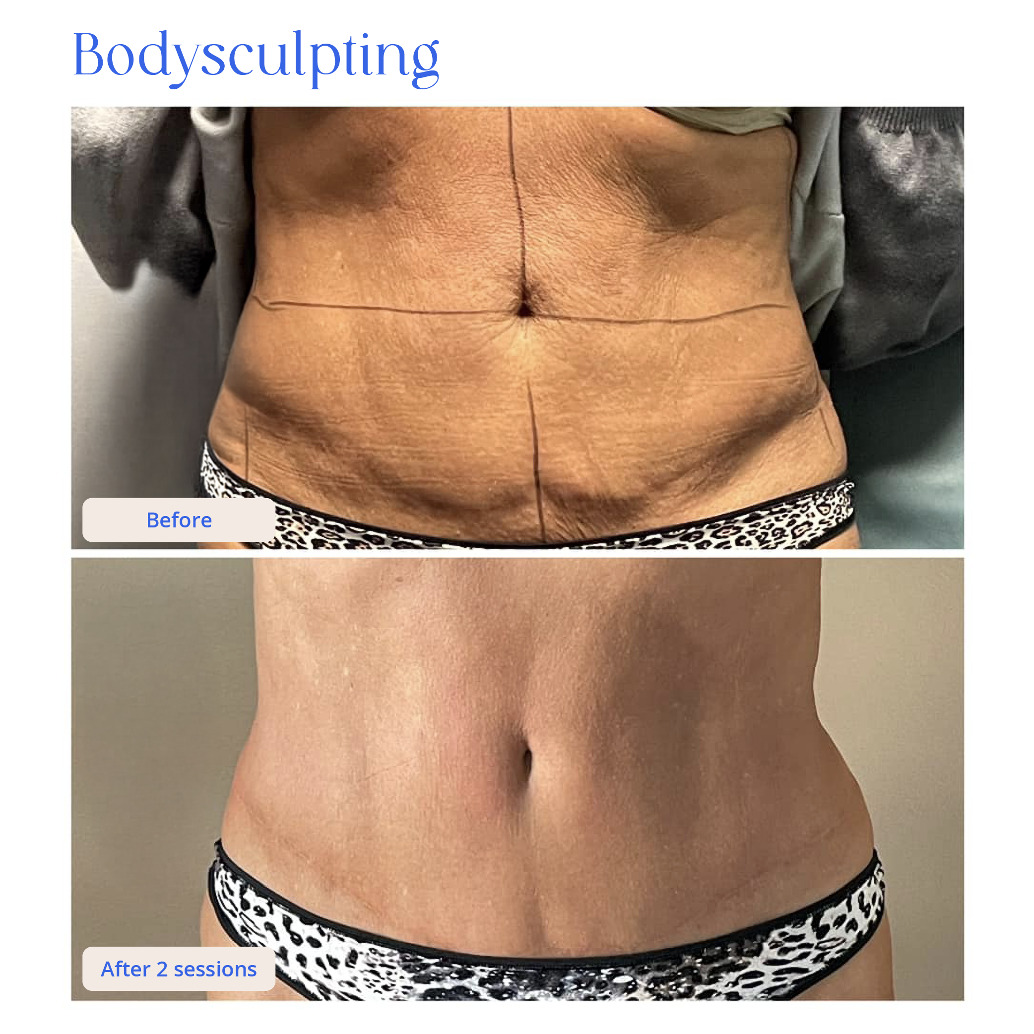 Before and After Result 5