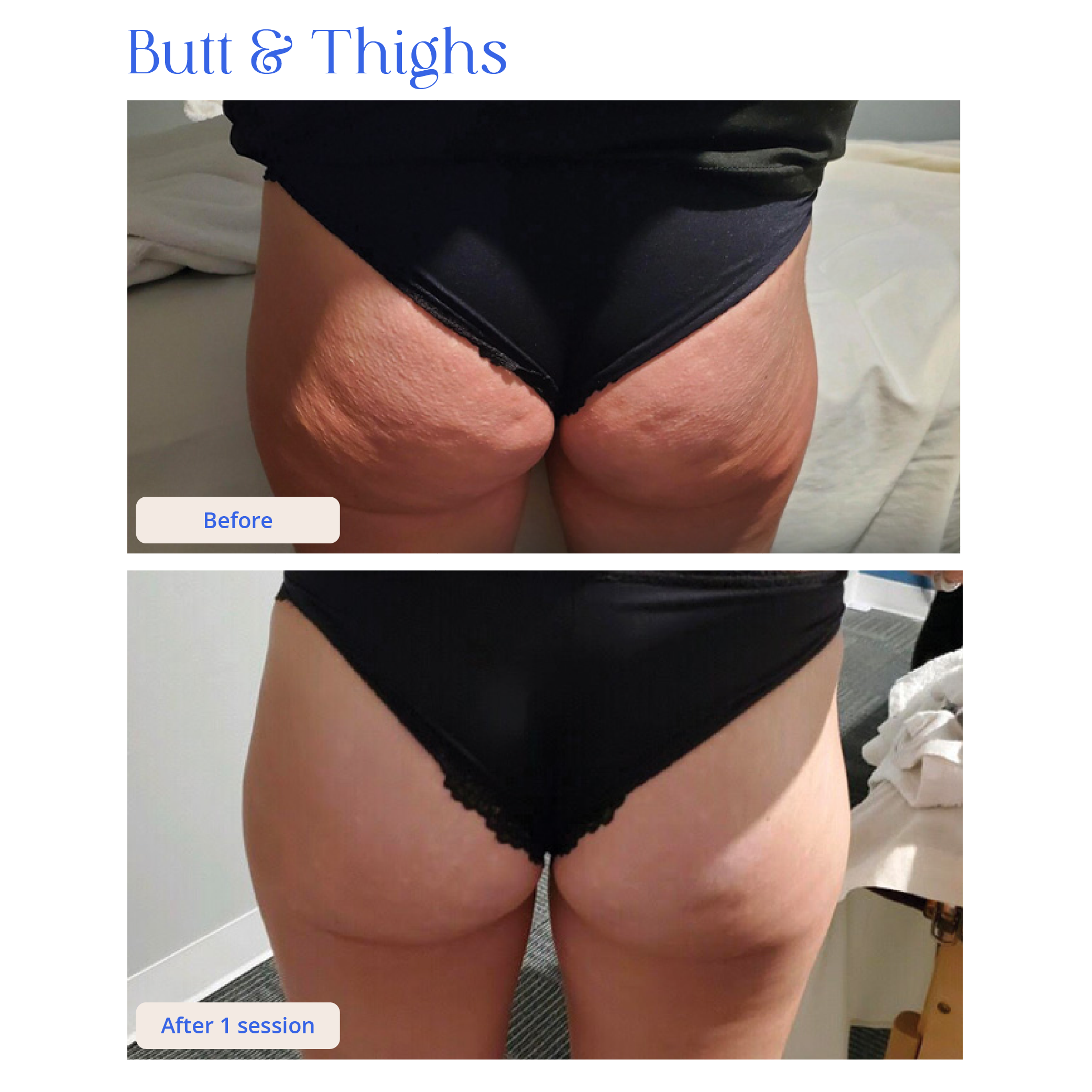 Before and After Result 6