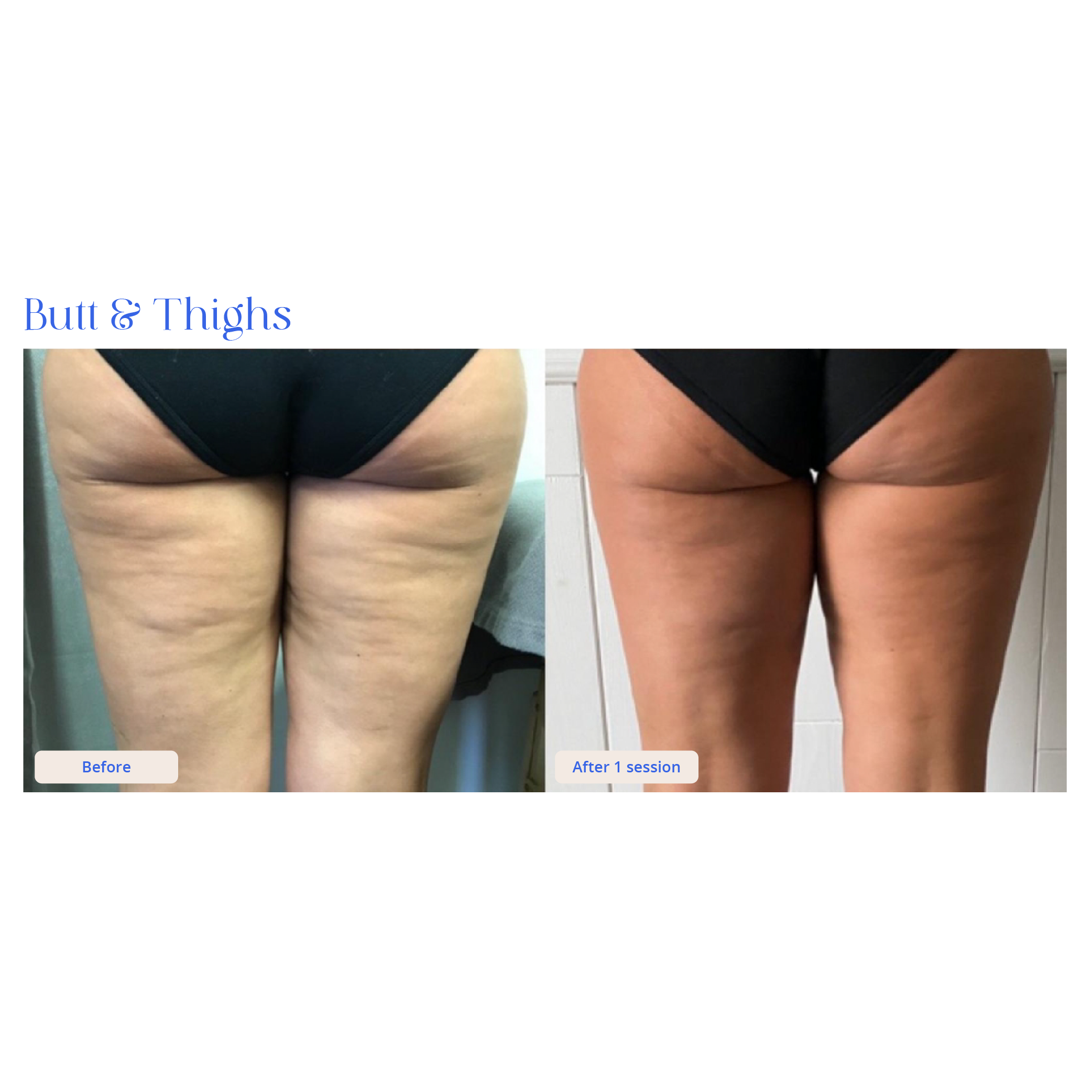 Before and After Result 7