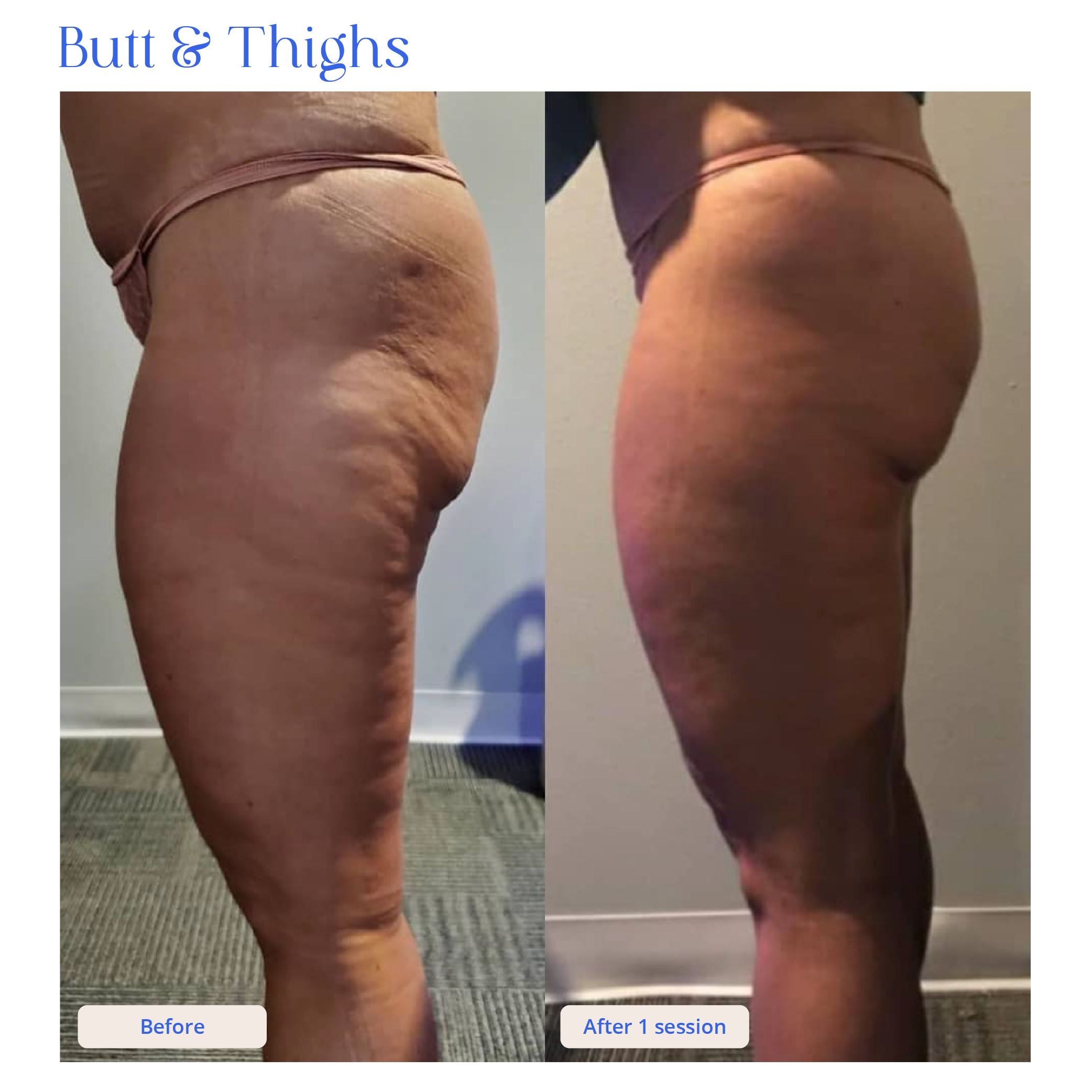 Before and After Result 8