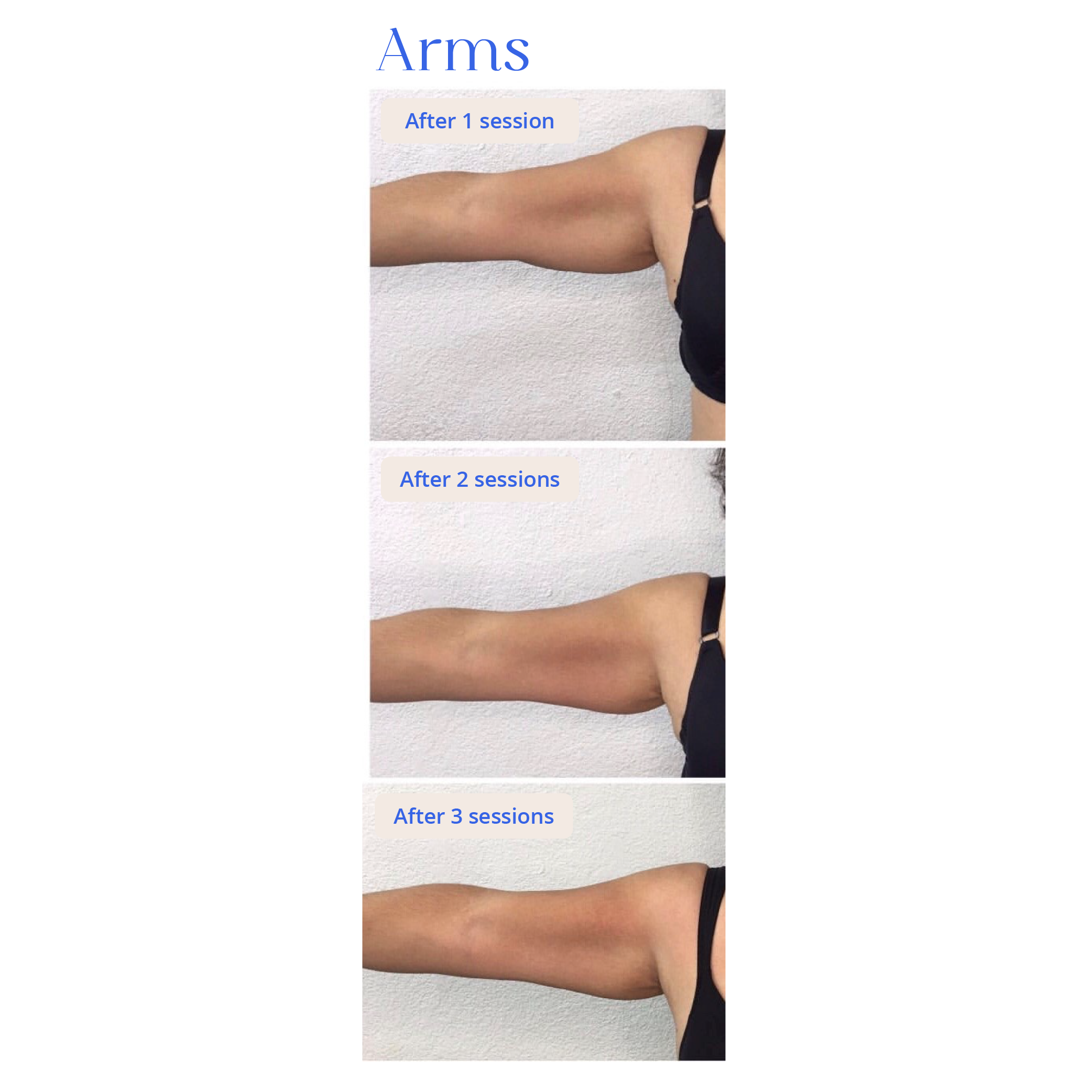 Before and After Result 9
